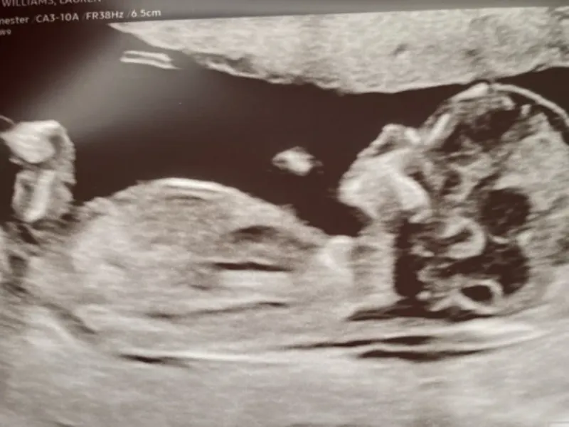 4c5543 0169e0f69da24d4bb039ec57a56502e2mv2